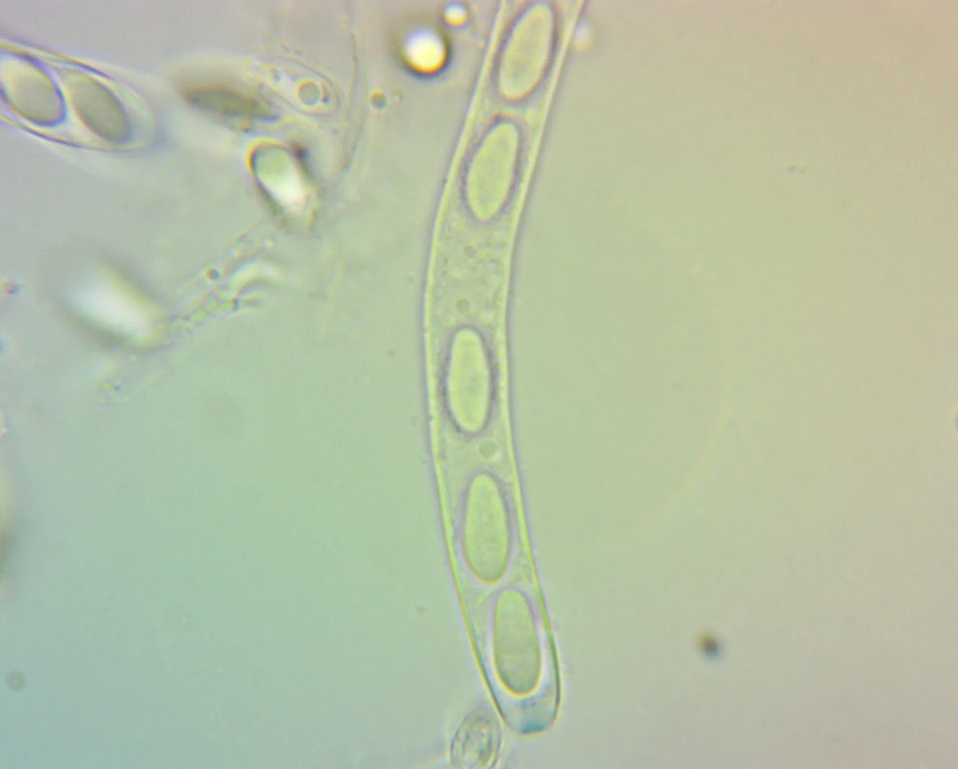 Microscopía de Dumontinia tuberosa - asco, melzer